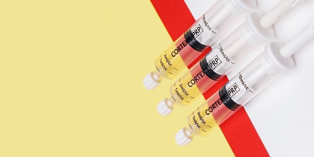 ПЛАЗМОТЕРАПИЯ CORTEXIL PRP